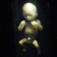 Fetus Dimension